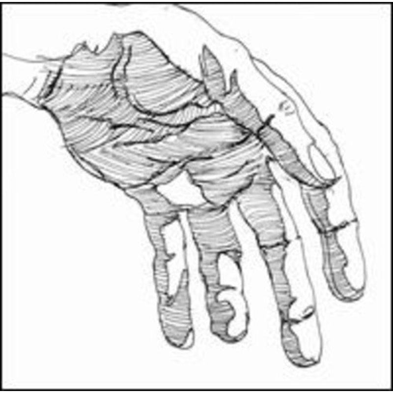 With Hands of the Hunter It All Becomes Dead